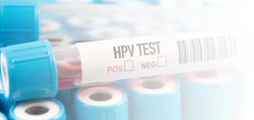 HPV nasıl bulaşır